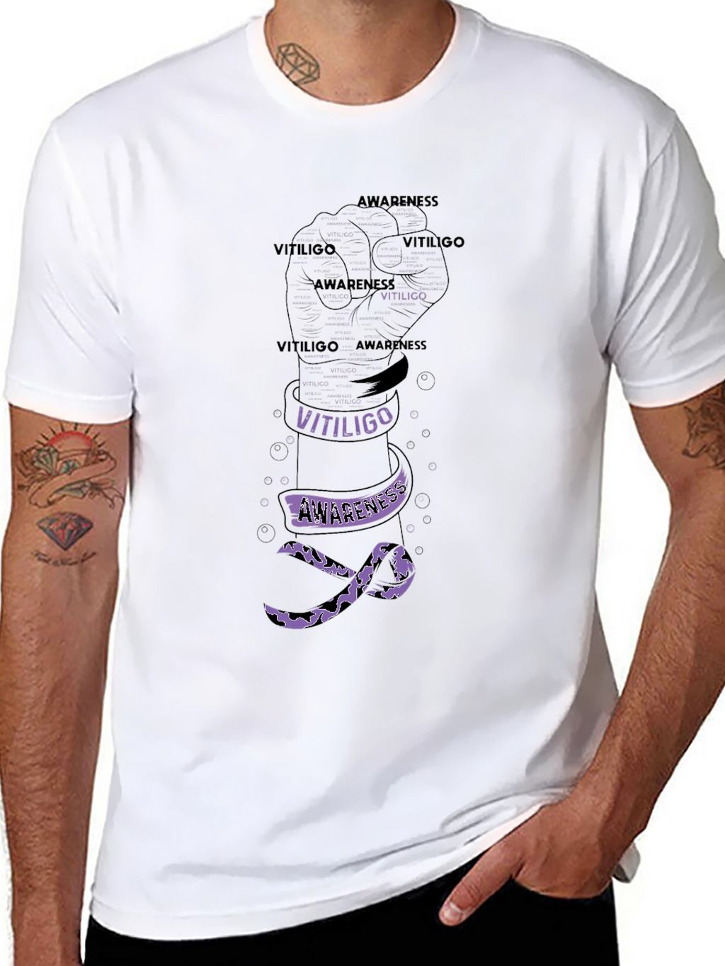 Vitiligo Awareness Fist T-Shirt
