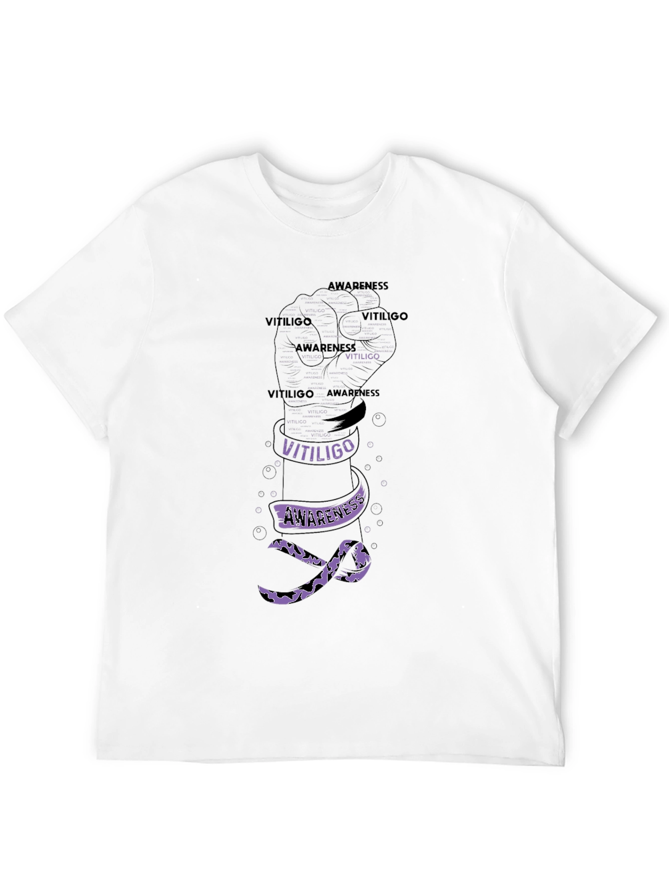 Vitiligo Awareness Fist T-Shirt