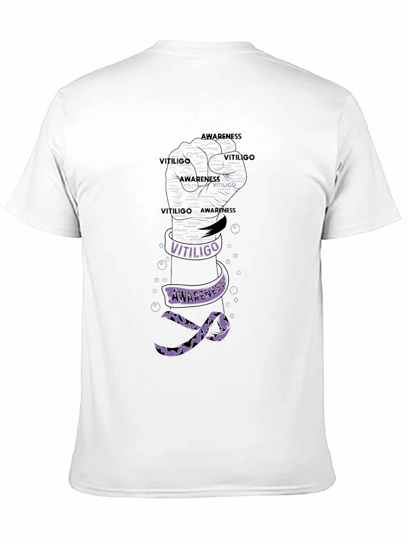 Vitiligo Awareness Fist T-Shirt