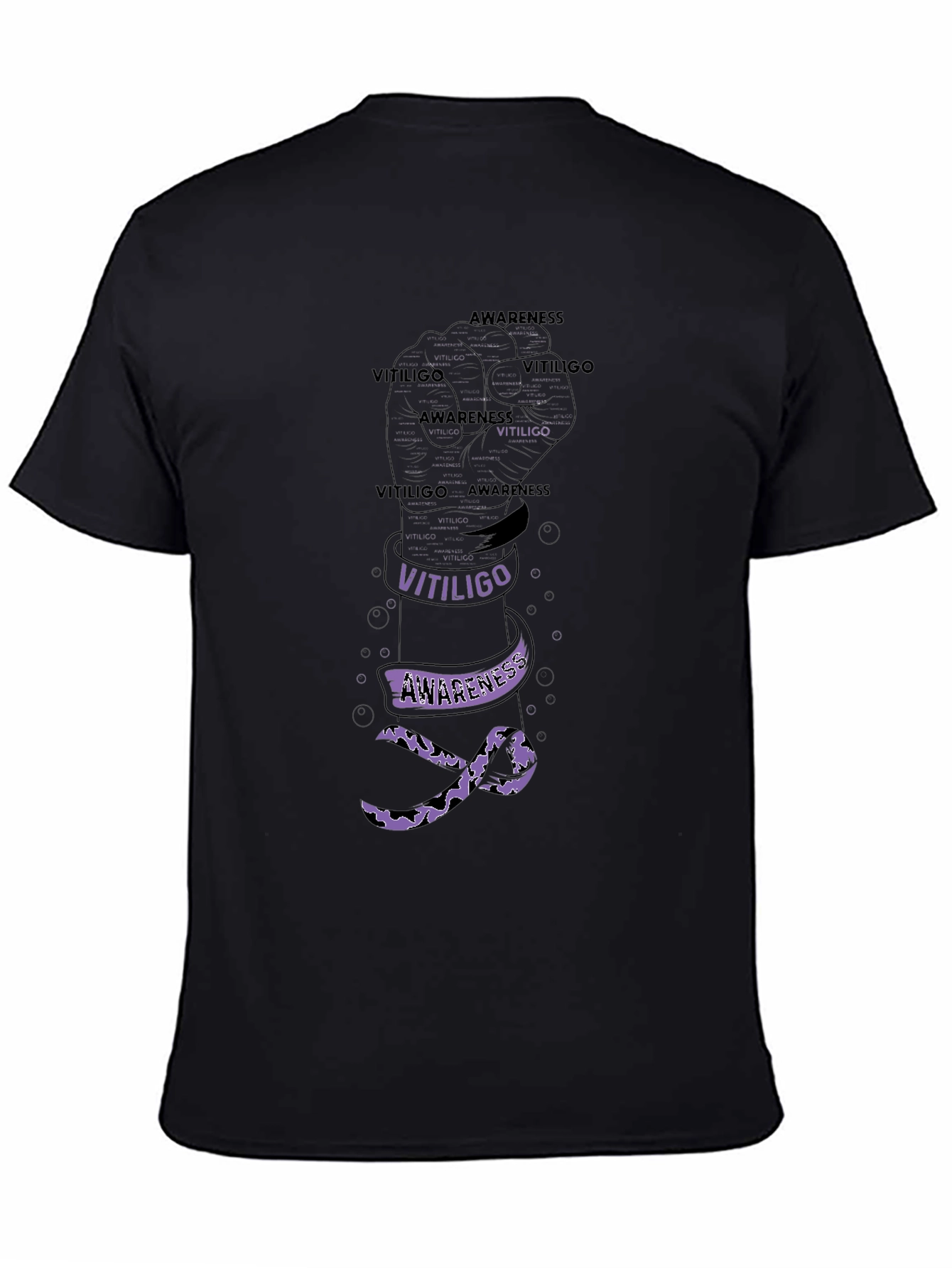 Vitiligo Awareness Fist T-Shirt