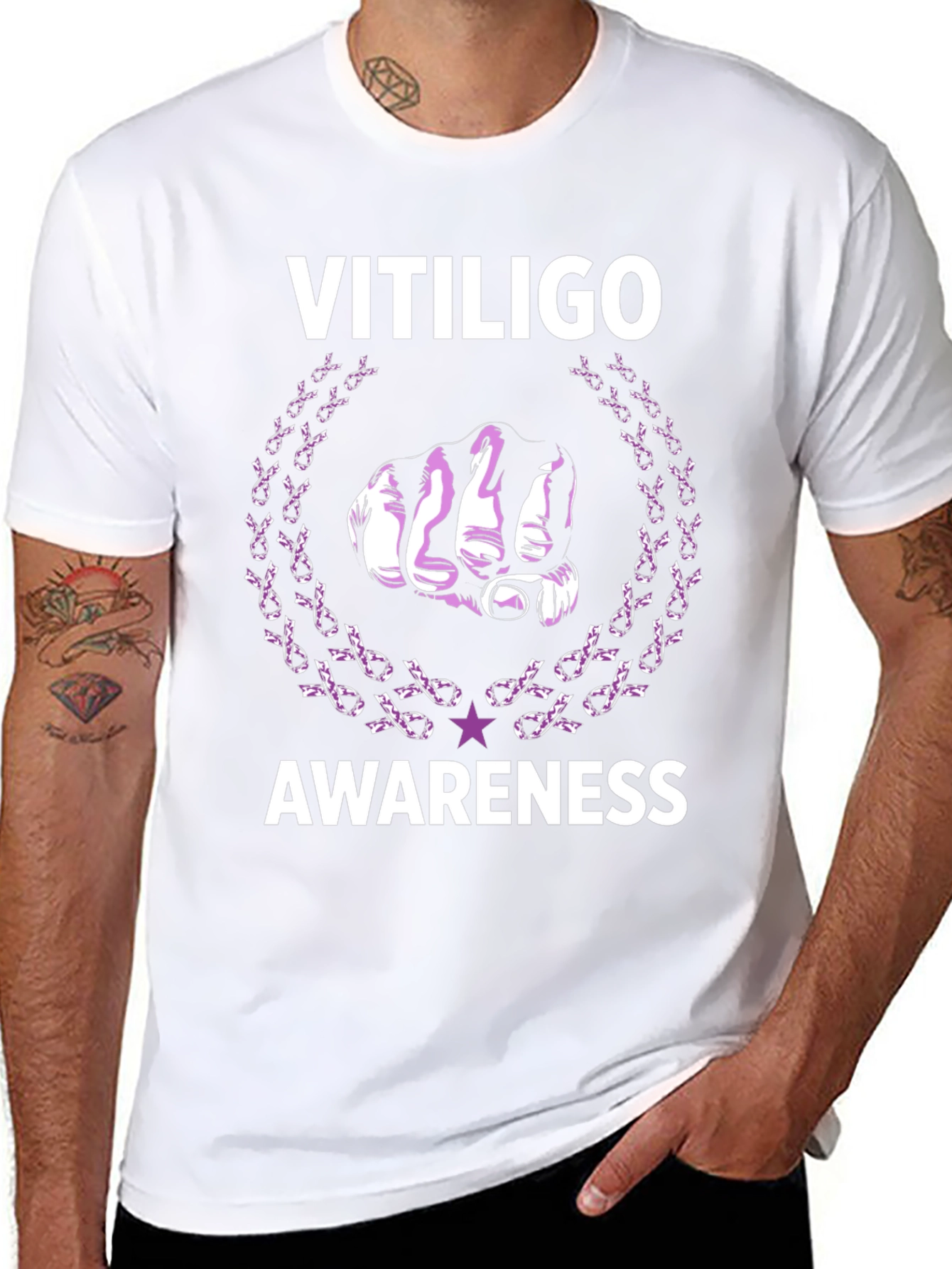 Vitiligo Awareness T-Shirt - Unisex Design
