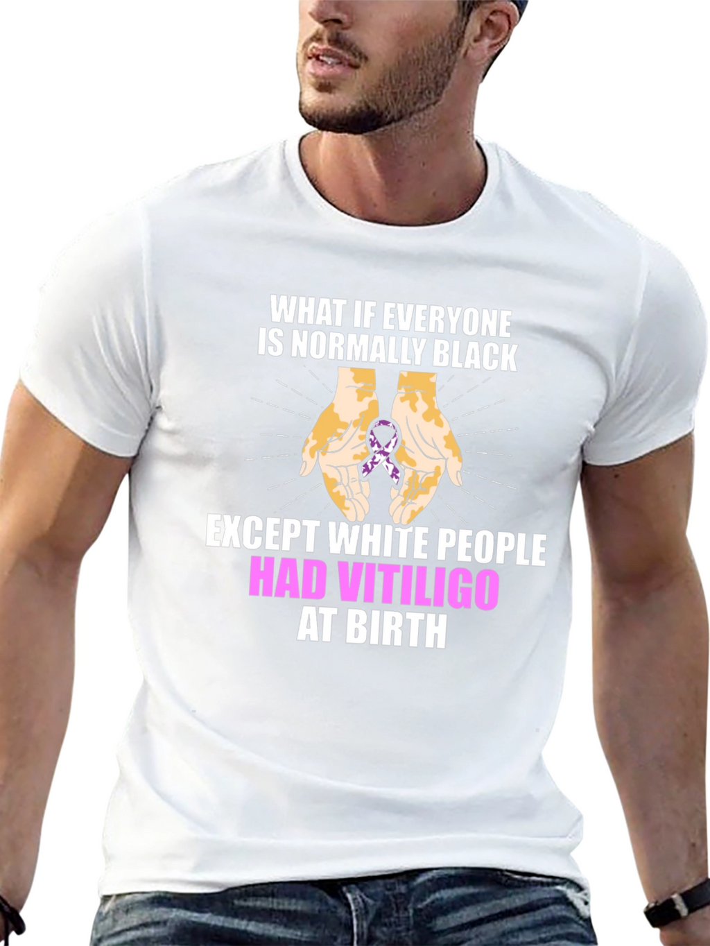 Vitiligo Awareness T-Shirt - Equality Design